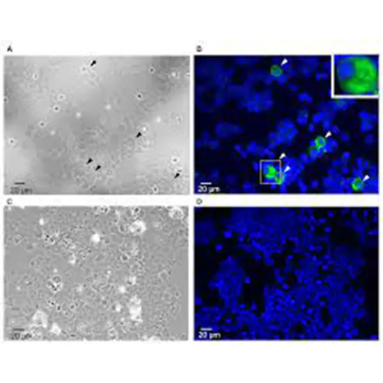 body effusion culture and sensitivity test